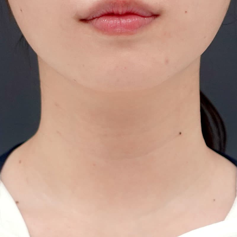 20251123_St20251123_fujita_bio sculpture neck①After