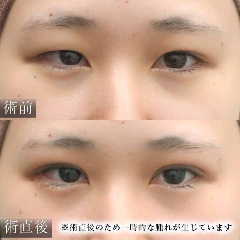 20251127_N114245_ono_double-burial-methodメイン横