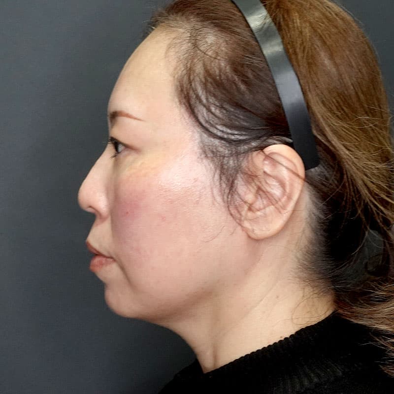 20251127_N142270_nagahama_extended MACSlift①After