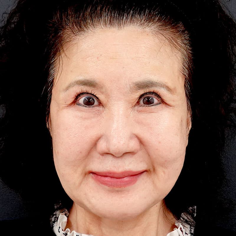 20251212_Y125319_takee_extended MACSlift①After