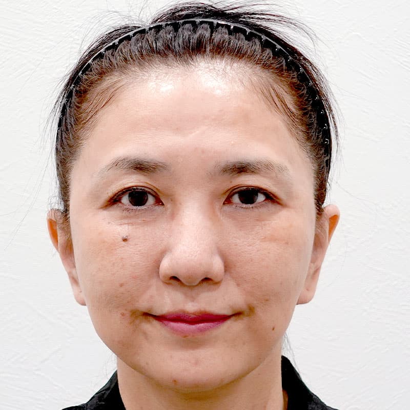 20251215_G30538_takee_face lift①After