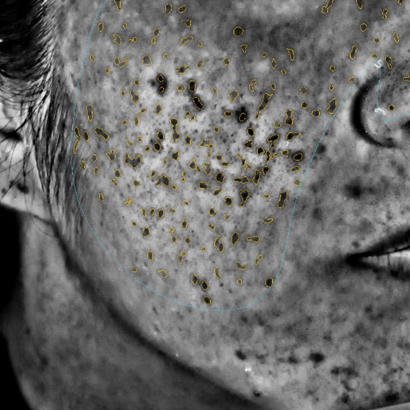 20251223_N33826_picolaser①After