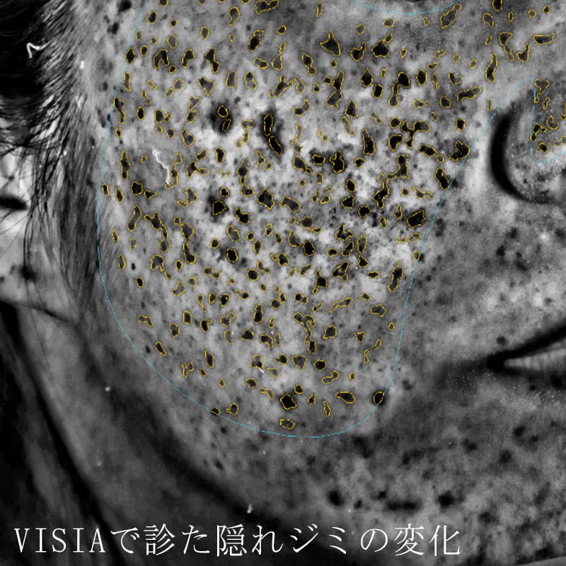 20251223_N33826_picolaser①Before