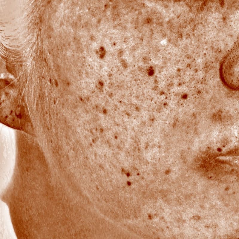 20251223_N33826_picolaser②After