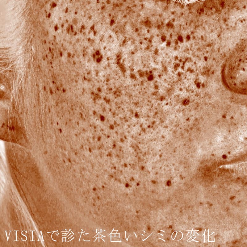 20251223_N33826_picolaser②Before