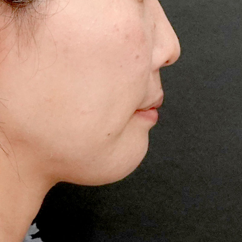 20260120_G110718-1_nishida_setback①After