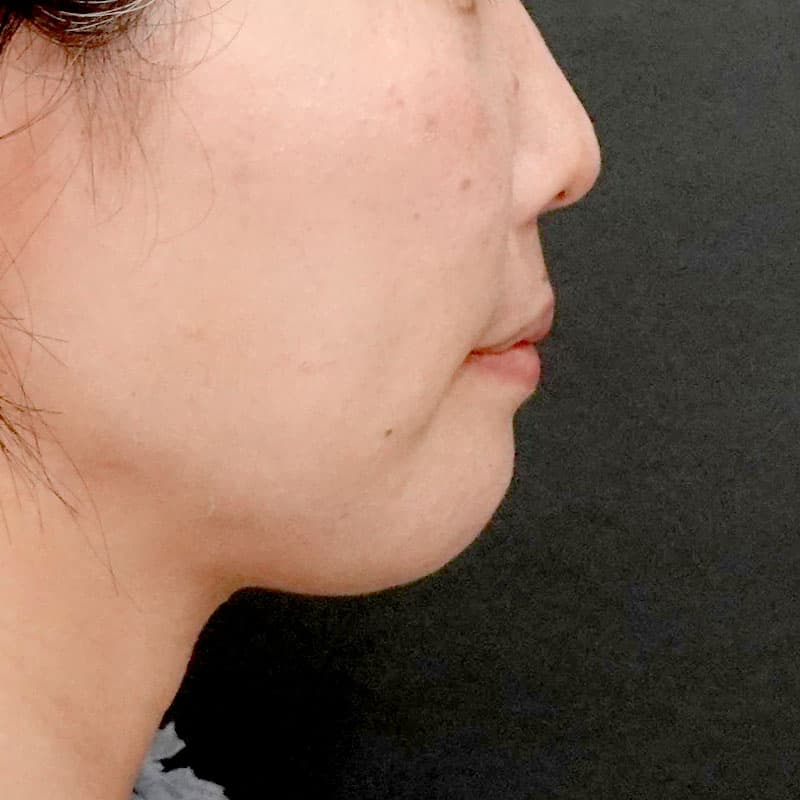 20260120_G110718-1_nishida_setback①After