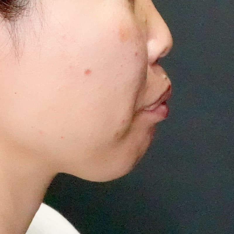 20260120_G110718-1_nishida_setback①Before