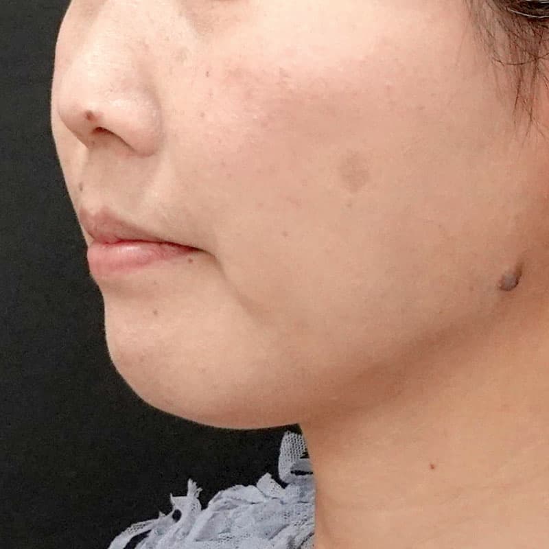 20260120_G110718-1_nishida_setback②After