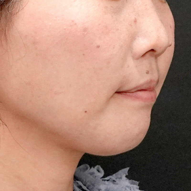 20260120_G110718-1_nishida_setback③After