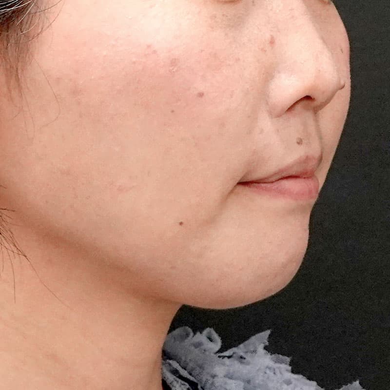 20260120_G110718-1_nishida_setback③After