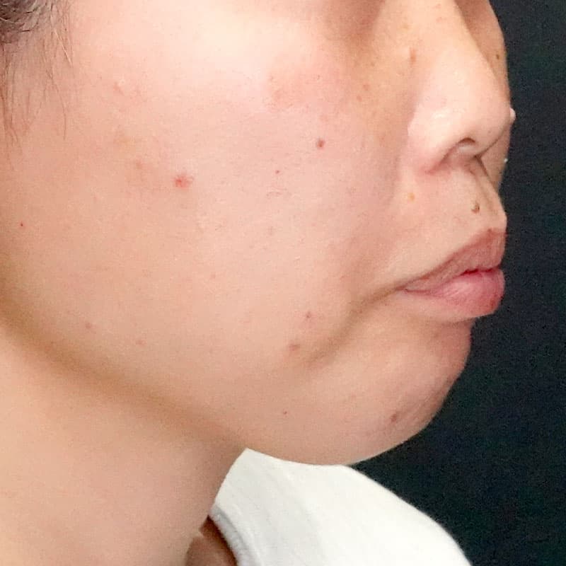 20260120_G110718-1_nishida_setback③Before