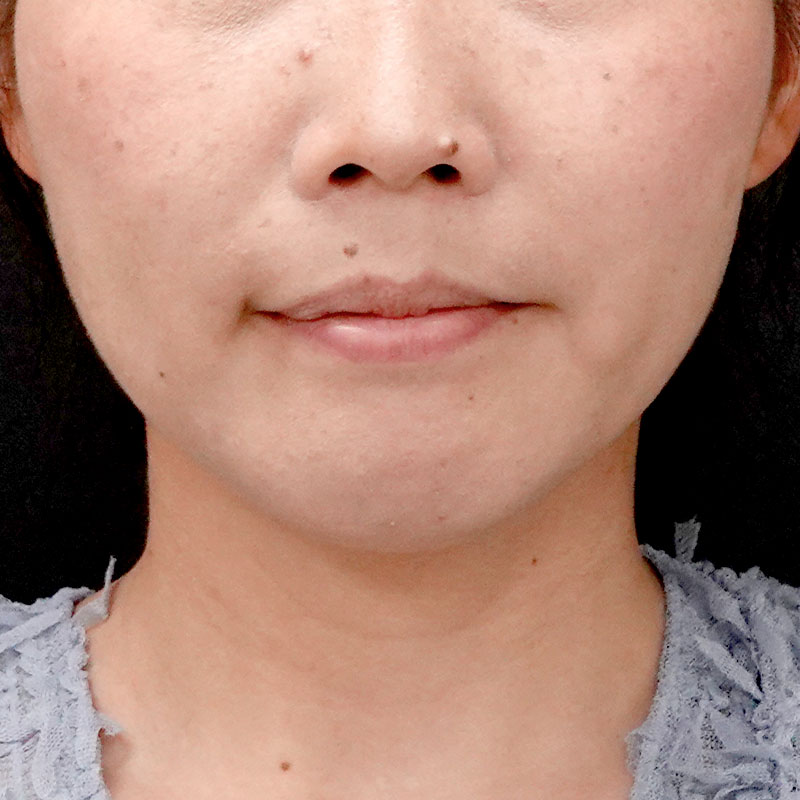 20260120_G110718-1_nishida_setback➃After