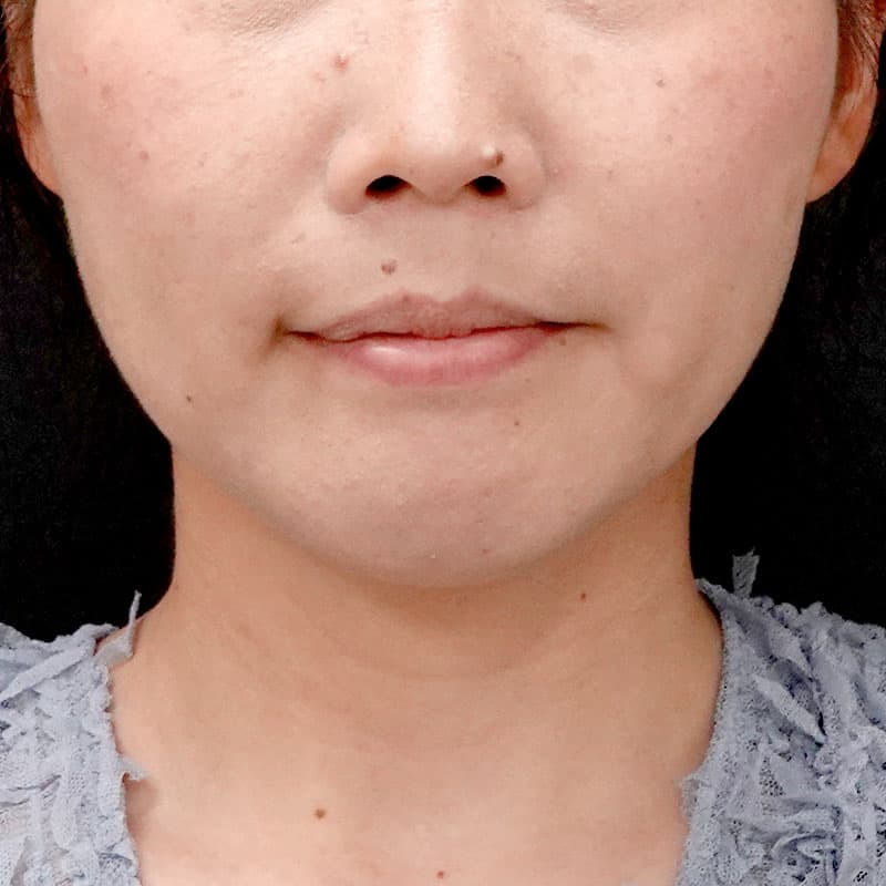 20260120_G110718-1_nishida_setback➃After