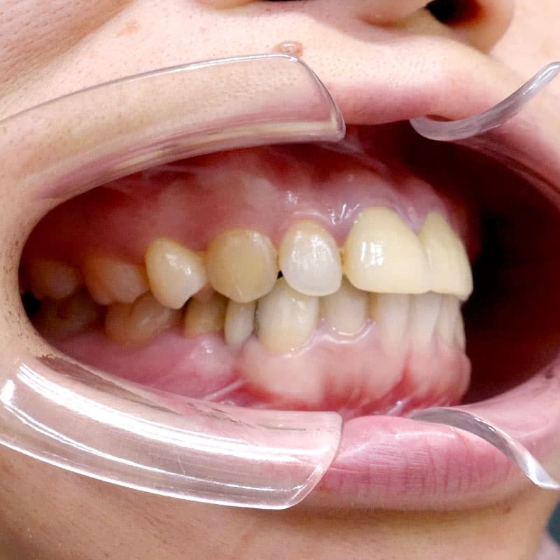 20260120_G110718_nishida_setback①After