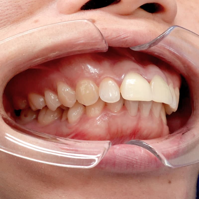 20260120_G110718_nishida_setback①Before