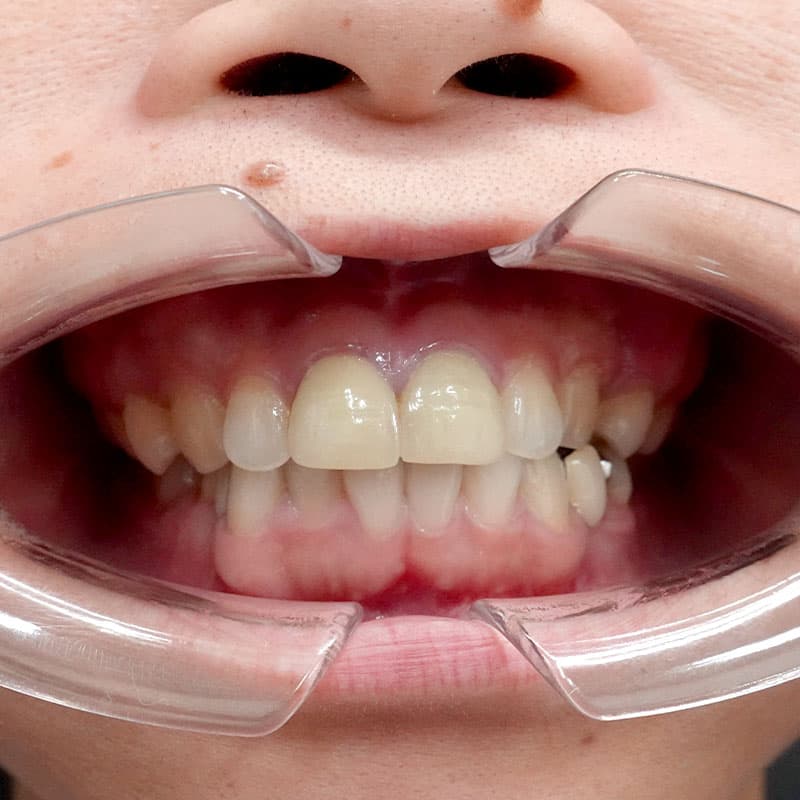 20260120_G110718_nishida_setback②After