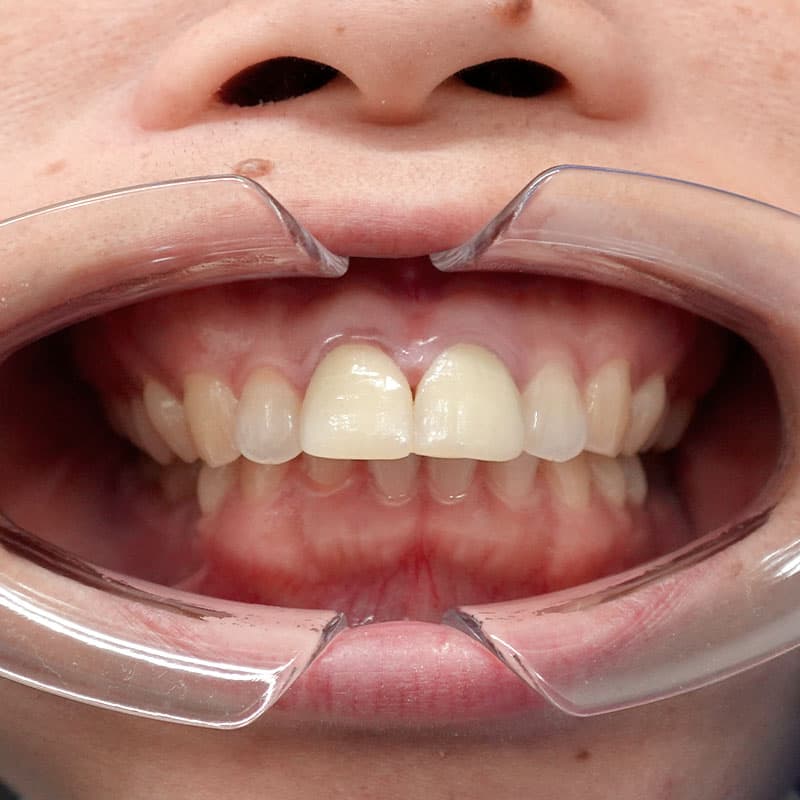 20260120_G110718_nishida_setback②Before