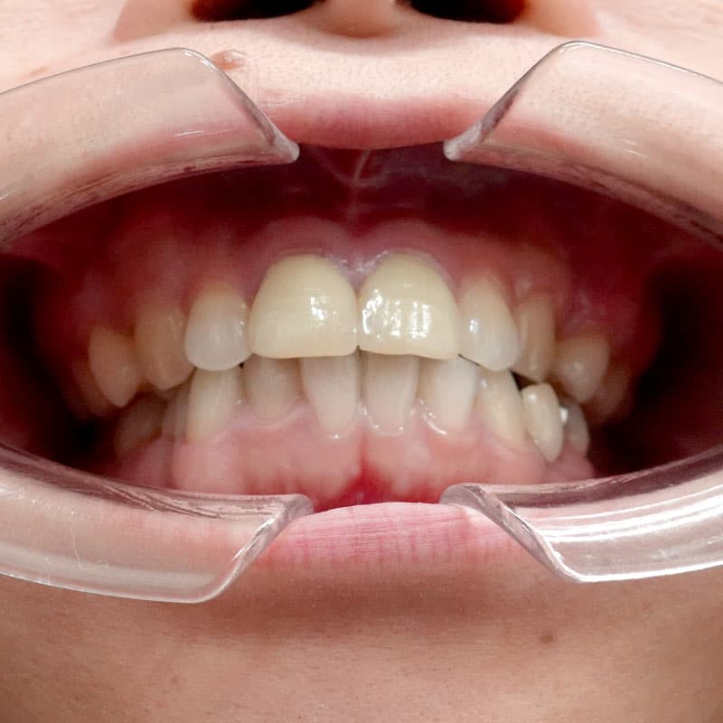 20260120_G110718_nishida_setback③After