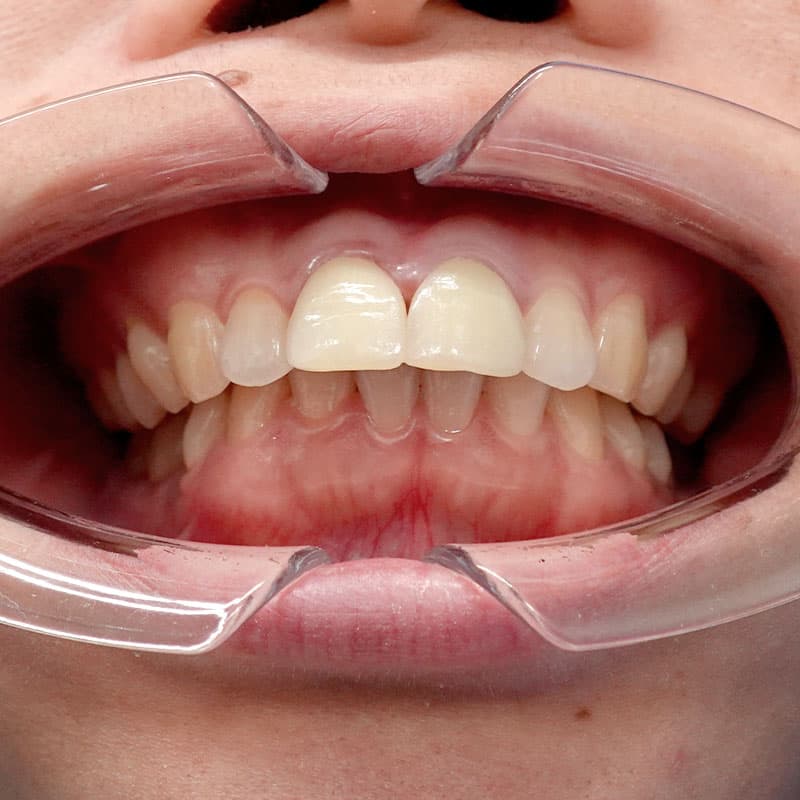 20260120_G110718_nishida_setback③Before