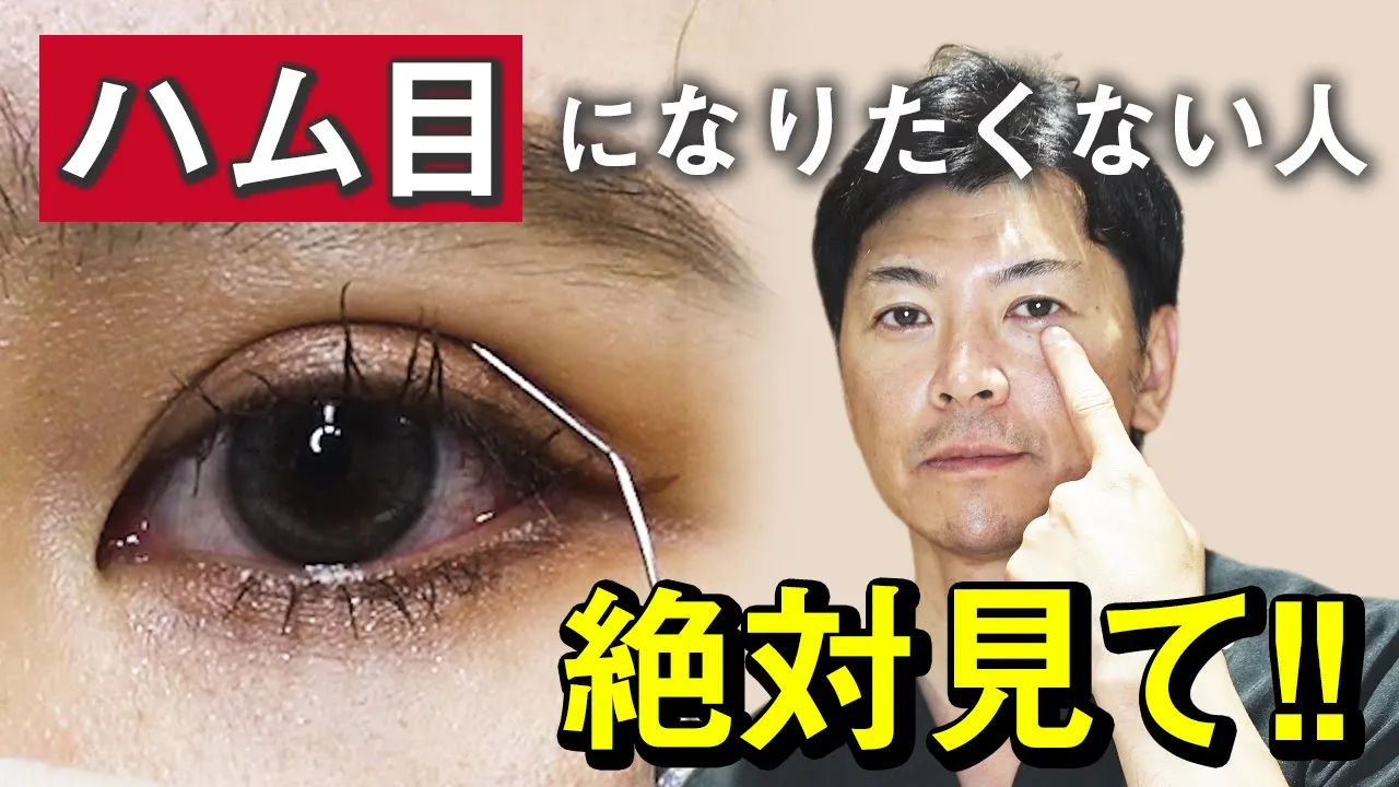 二重埋没法のハム目の原因とは？｜防ぐポイントやハム目になる原因を徹底解説！