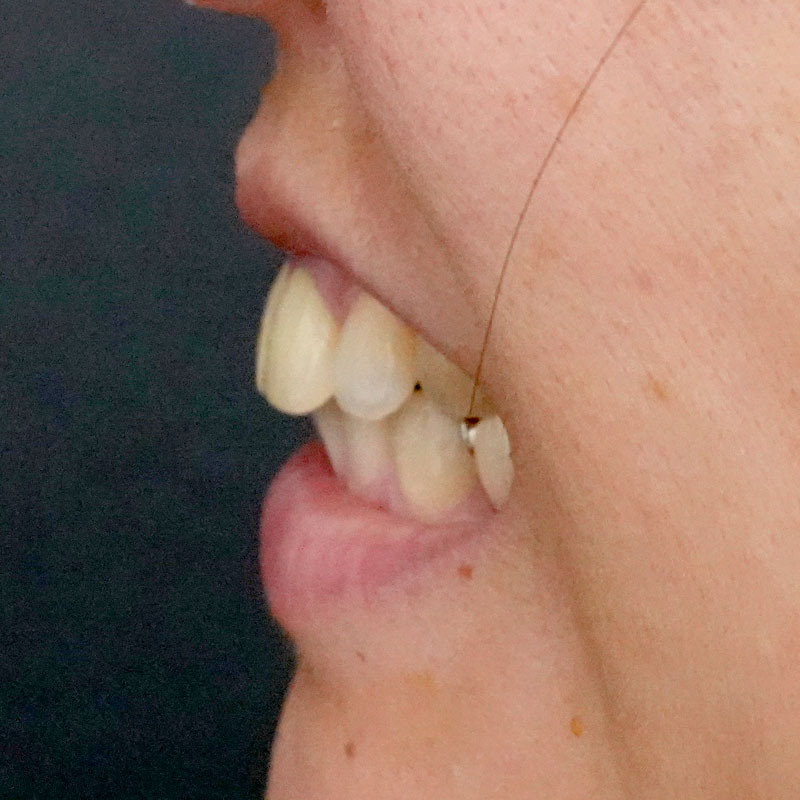 20260208_G11718_nishida_setback①After