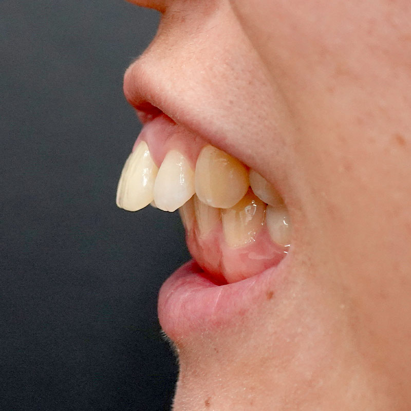 20260208_G11718_nishida_setback①Before