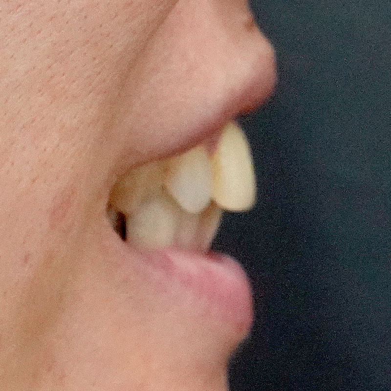 20260208_G11718_nishida_setback②After