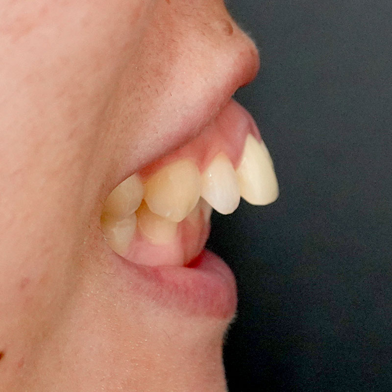 20260208_G11718_nishida_setback②Before