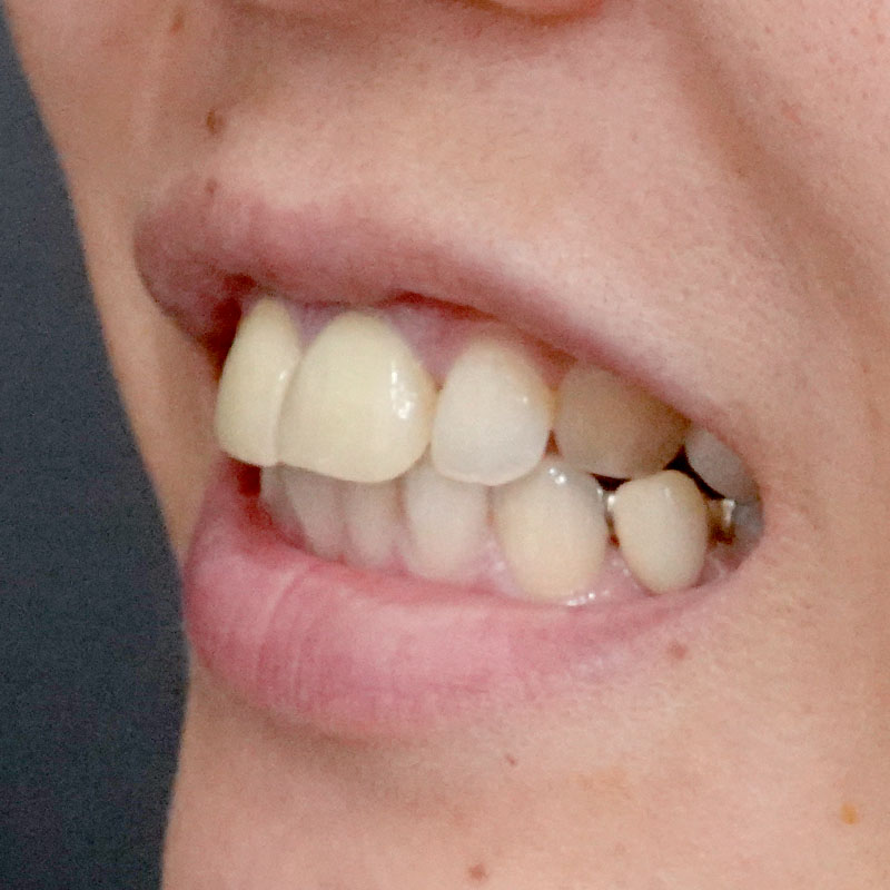 20260208_G11718_nishida_setback③After