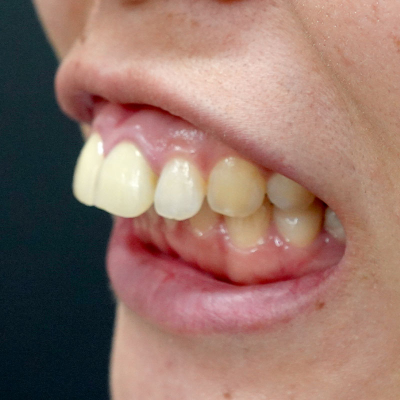 20260208_G11718_nishida_setback③Before