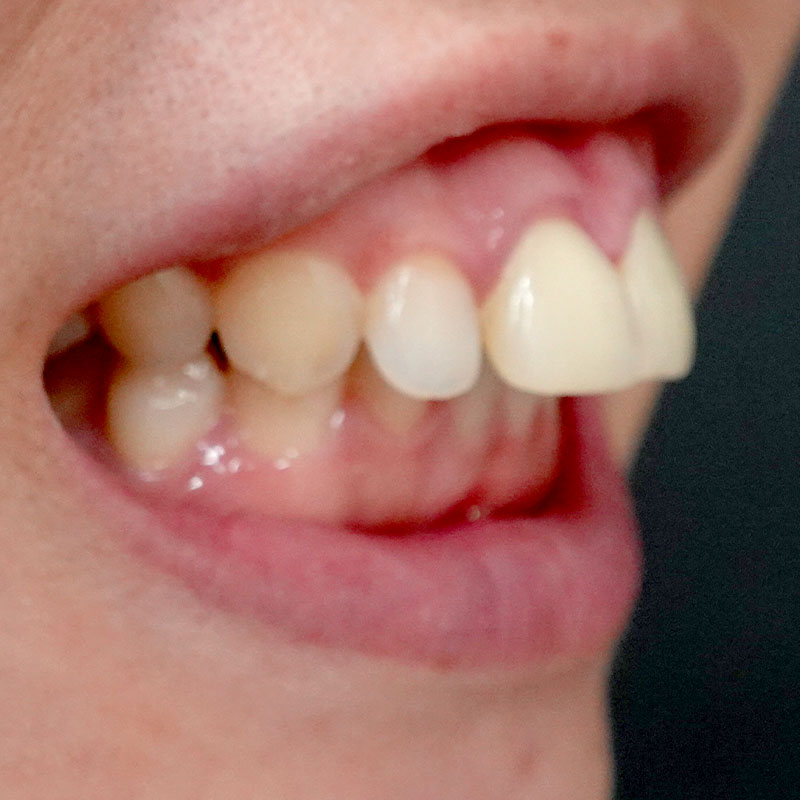 20260208_G11718_nishida_setback➃Before