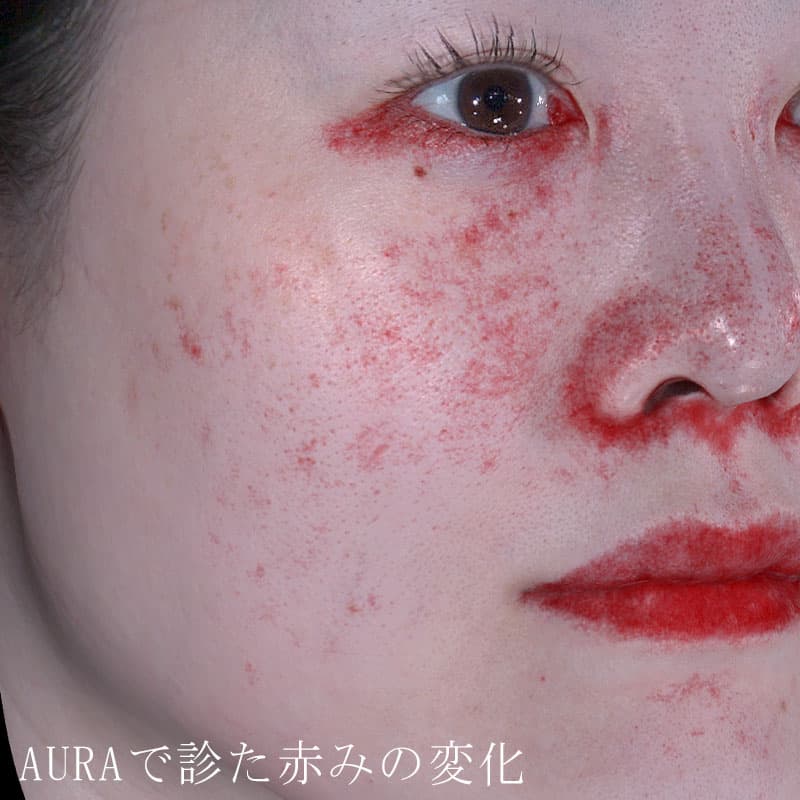 20260214_St20260214-1_mesonaj②Before (1)