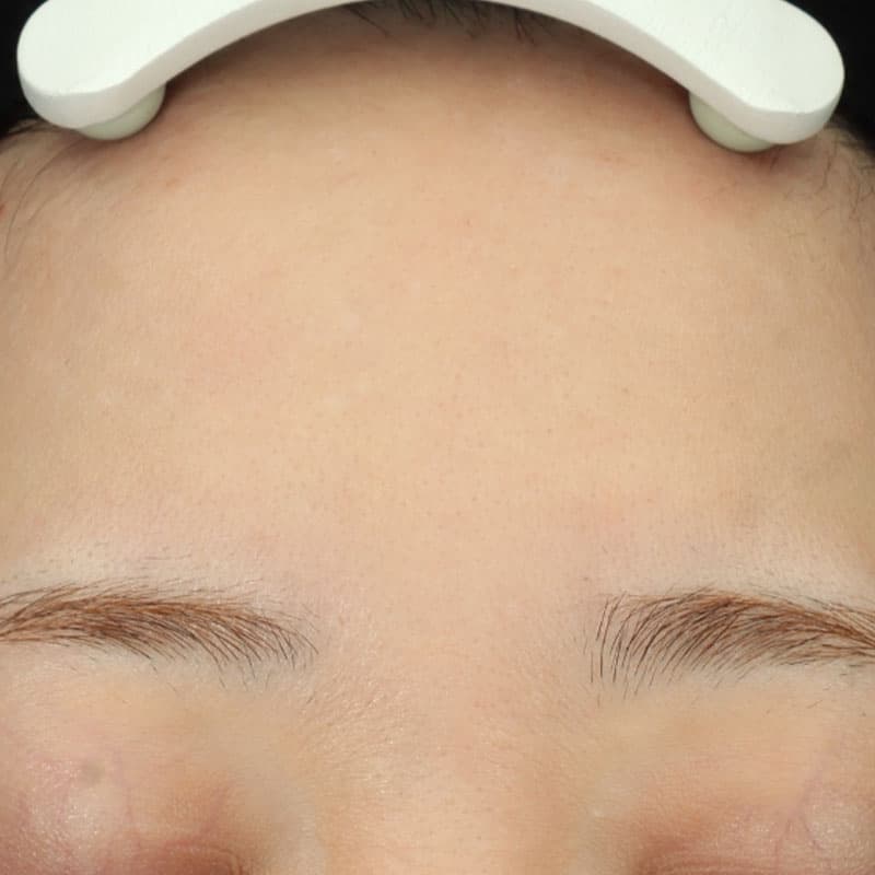 20260216_G151199_hydra booster-blessing-mesonaj①After