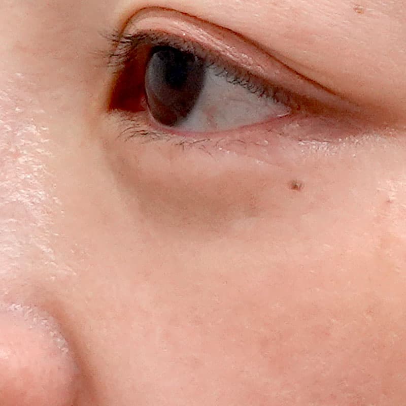 20260219_G40318_takemura_back-hamura-method①After