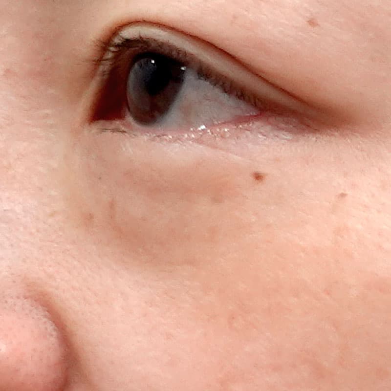 20260219_G40318_takemura_back-hamura-method①Before