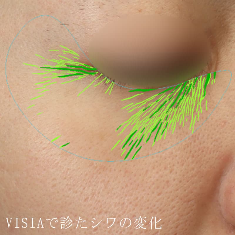 20260223_N48013_blessing①Before