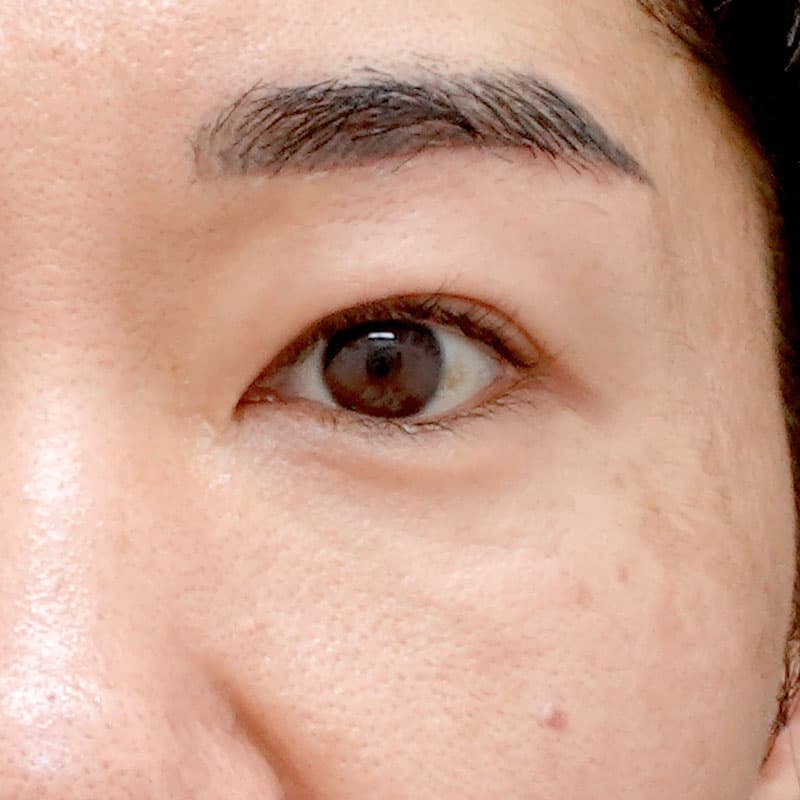 20260315_N138034_takemura_back-hamura-method①After