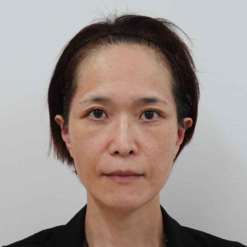 20260401_Y143455_takee_extended MACSlift①After