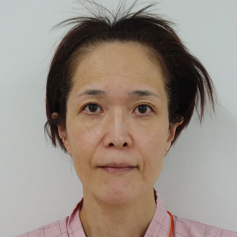 20260401_Y143455_takee_extended MACSlift①Before