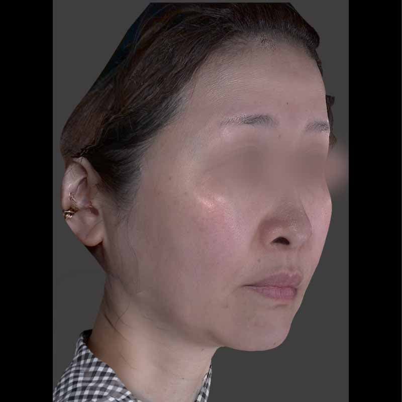 20260415_H164039_volformer①After