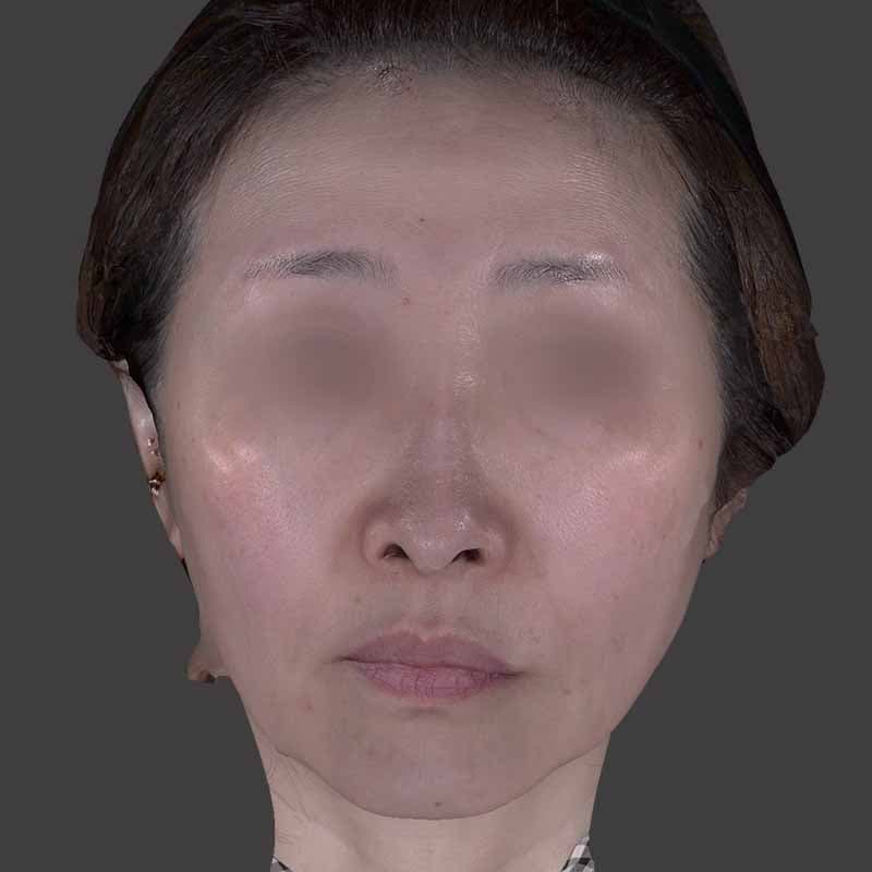 20260415_H164039_volformer②After