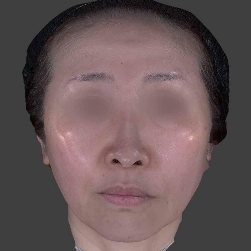 20260415_H164039_volformer②Before