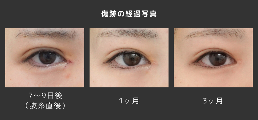 経過写真