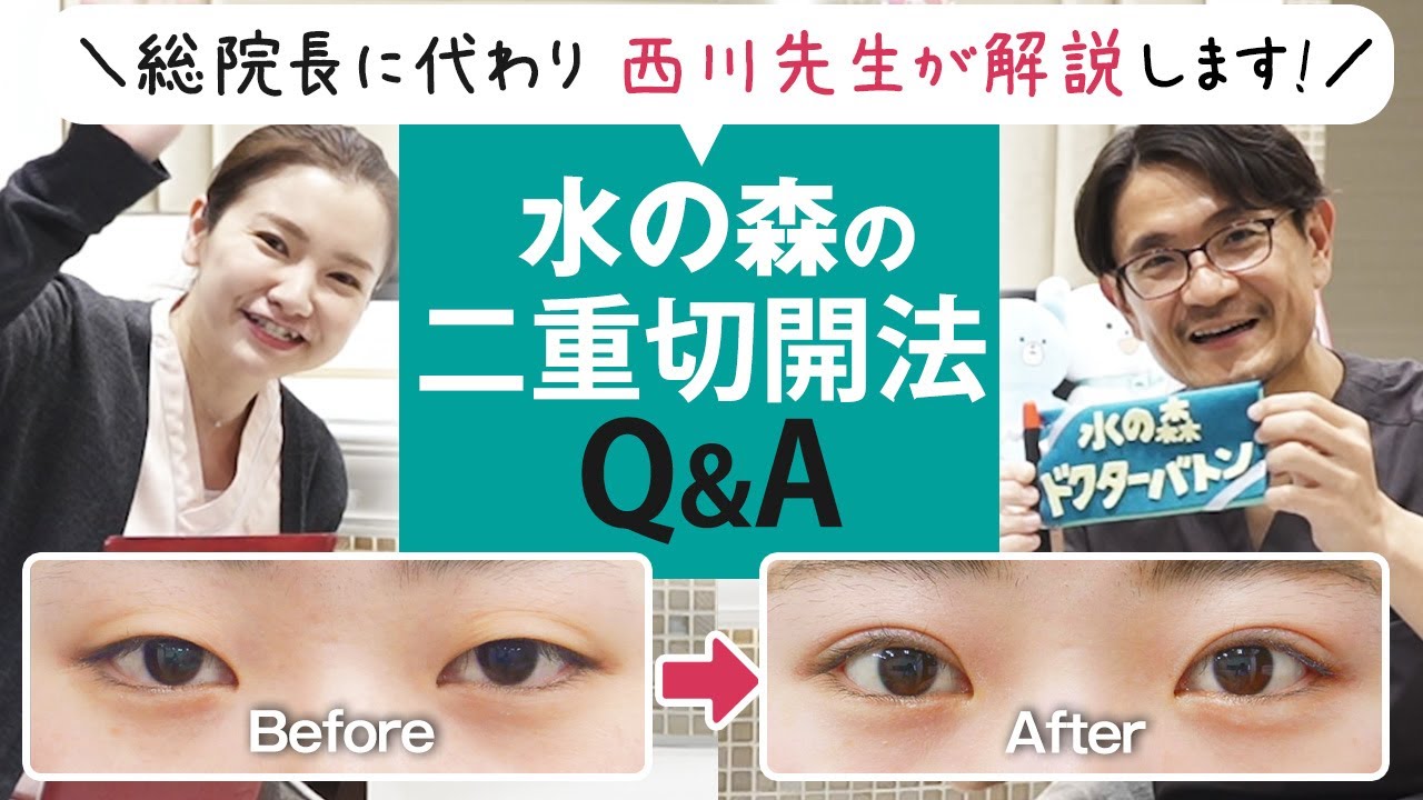 【二重切開法Q&A】埋没法から切開は抜糸が必要？目の上のたるみ解消もできる？