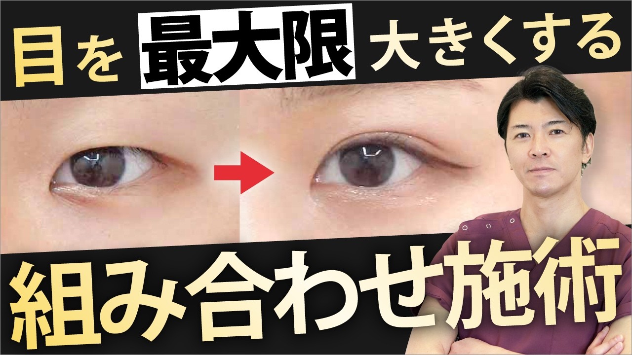 【医師解説】二重整形に組み合わせるならこれ！目を大きくする美容整形をご紹介