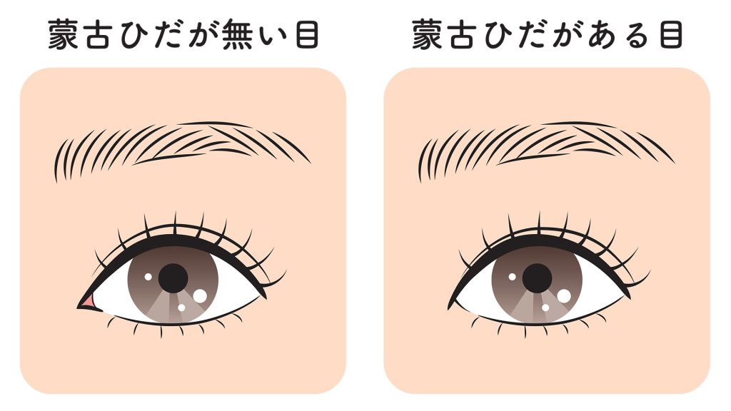 蒙古襞とは
