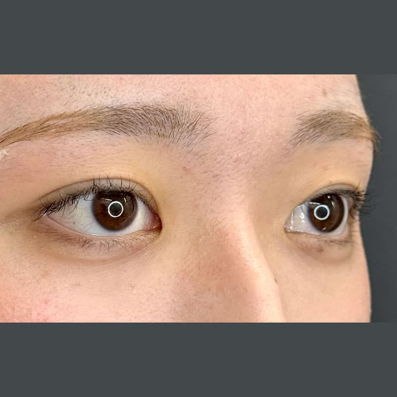 20260509_F168500_kadoya_natural adhesion method②After