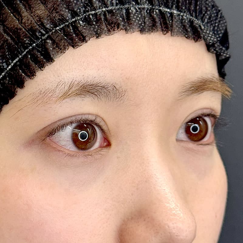 20260523_F173648_kadoya_natural adhesion method①After