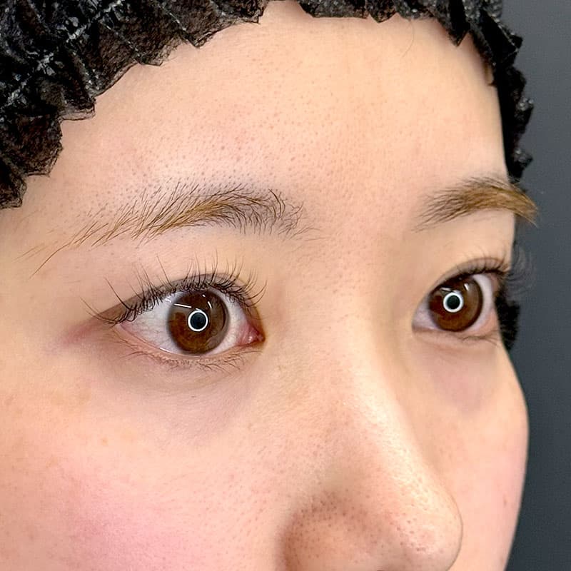 20260523_F173648_kadoya_natural adhesion method①Before